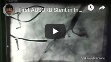 first-absorb-stent-drvtshah